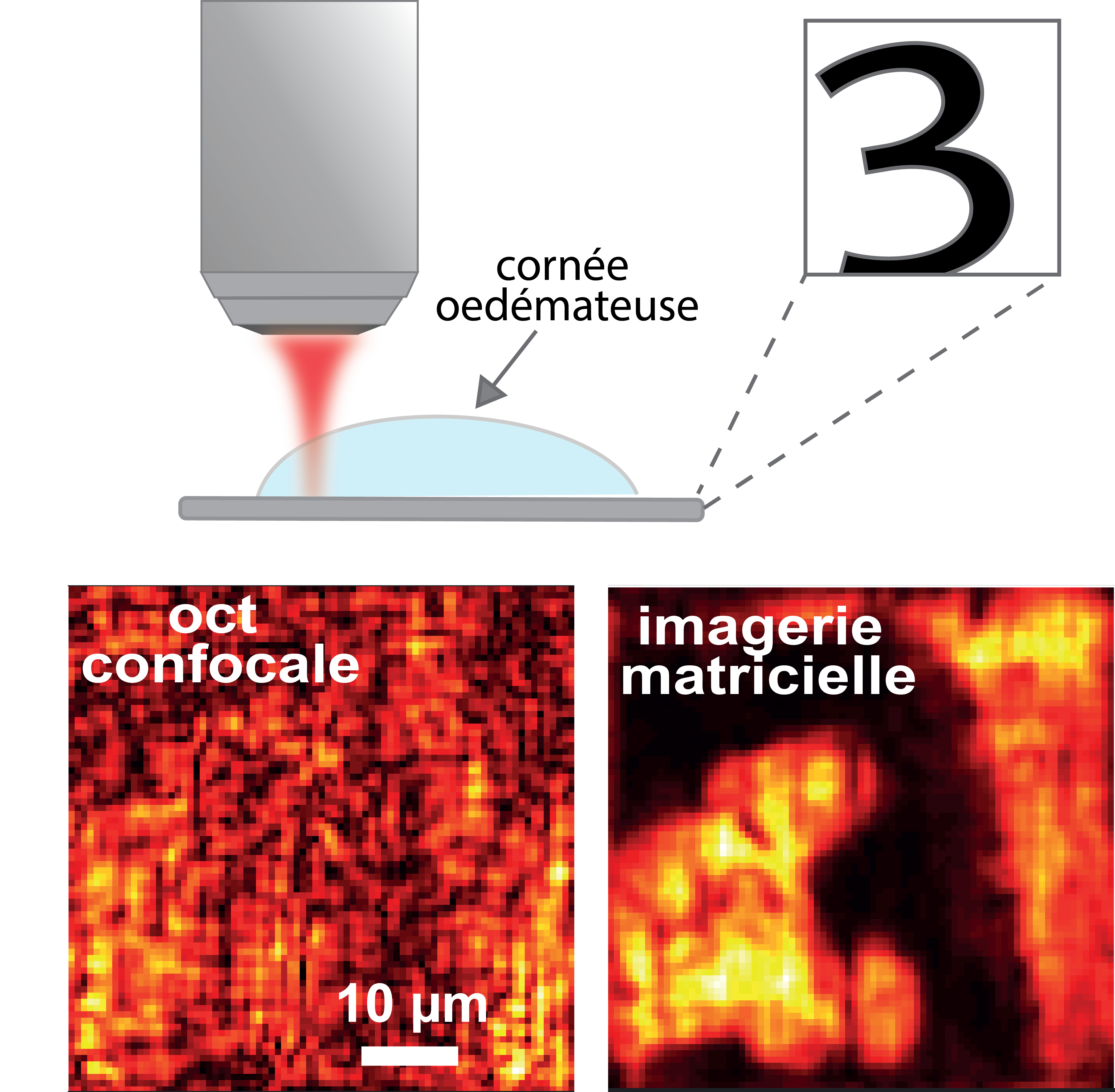 Images d’une mire de résolution à travers une cornée de singe fortement opaque. L’imagerie matricielle (à droite) révèle les détails de la mire qui sont totalement indétectables en (à gauche) du fait des fortes aberrations et de la diffusion multiple induites par la cornée © A. Aubry