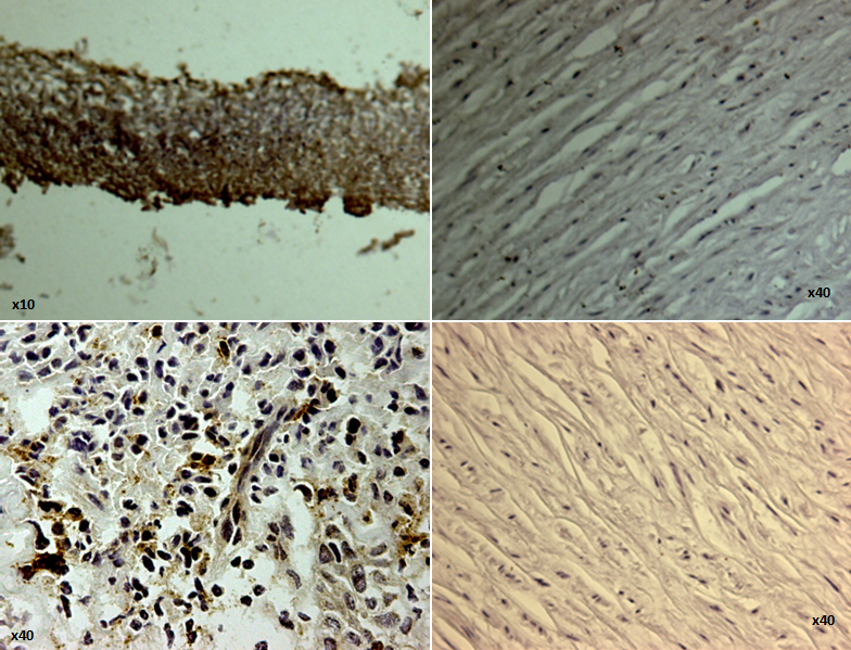 Échantillons de biopsies obtenus à partir de l'allogreffe aortique cryo-conservée (AAC) avant et 39 mois après transplantation trachéale