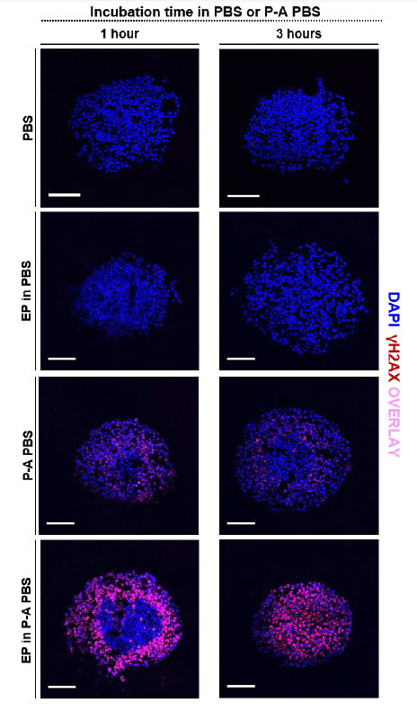 Potentialisation de l’effet cytotoxique du PBS exposé au plasma par les champs électriques pulsés dans un modèle 3D de tumeur. © Elena Griseti
