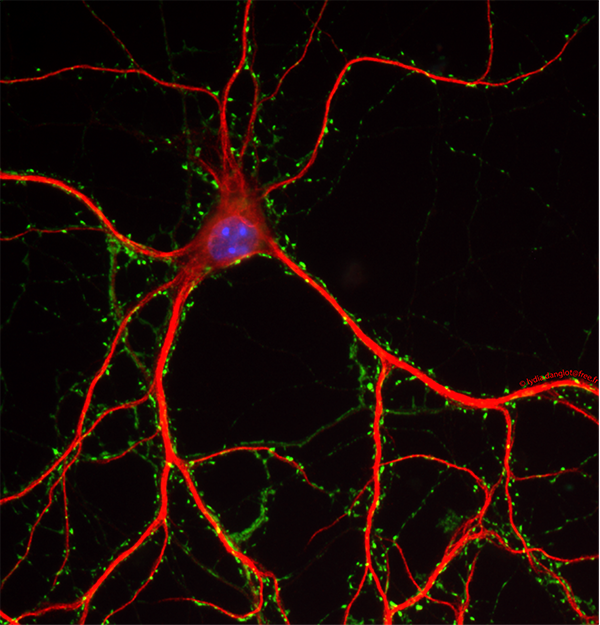 Neurones d’hippocampe identifié grâce à ces prolongements dendritiques marqués en rouge (MAP2) par une protéine associée aux microtubules et ses contacts synaptiques en vert (synapsine). © Lydia Danglot (Institut de Psychiatrie et neurosciences de Paris)