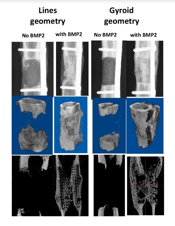 Reproduced from Garot et al. Adv Healthcare Materials 2023 (CC BY 4.0 DEED). Images radiologiques (rangée du haut), et images scanner en 3D (rangée du milieu) et 2D (rangée du bas), montrant la reconstruction d'un métatarse de brebis avec deux échafaudages de géométries différentes et recouverts ou non de la molécule ostéoinductrice BMP-2. 