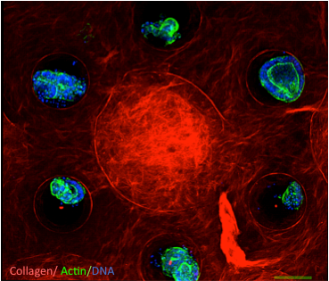 Ensemencement d’organoïdes intestinaux sur une structure 3D en collagène. © Descroix/Vignjevic (Institut Curie)