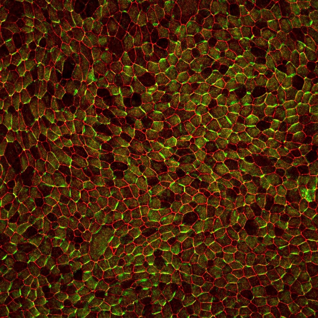 Vue microscopique d’un épithélium bronchique reconstitué in vitro. © Loiseau et al.