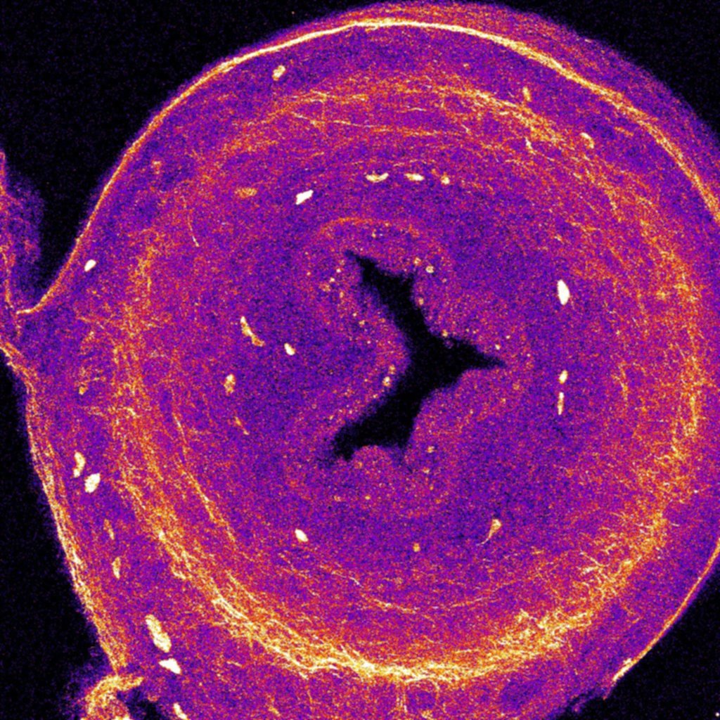 L’intestin, long de par ses propres contractions dans l’embryon