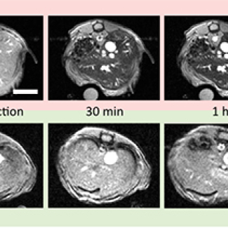 Des nanoparticules furtives pour l’imagerie par résonance magnétique