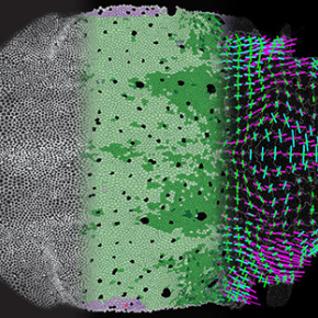 Biologie du développement : quels mécanismes régissent la dynamique des cellules et des tissus ?  